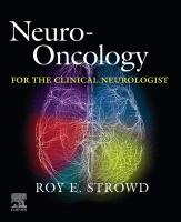 Neuro-Oncology-for-the-Clinical-Neurologist