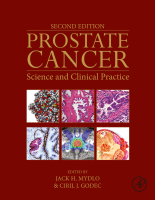 Prostate-Cancer,-Mydlo,-2nd-Edition