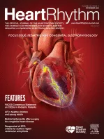 Heart Rhythm