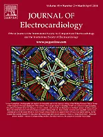 Journal of Electrocardiology