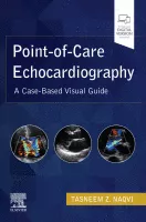 Point-of-Care Echocardiography, E-Book: A Clinical Case-Based Visual Guide