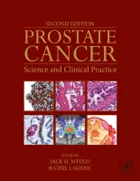 Prostate Cancer, Mydlo, 2nd Edition