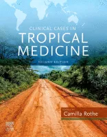 Clinical Cases in Tropical Medicine, Second Edition